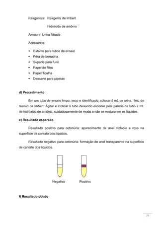 77
Reagentes: Reagente de Imbert
Hidróxido de amônio
Amostra: Urina flitrada
Acessórios:
Estante para tubos de ensaio
Pêra de borracha
Suporte para funil
Papel de filtro
Papel Toalha
Descarte para pipetas
d) Procedimento
Em um tubo de ensaio limpo, seco e identificado, colocar 5 mL de urina, 1mL do
reativo de Imbert. Agitar e inclinar o tubo deixando escorrer pela parede de tubo 2 mL
de hidróxido de amônio, cuidadosamente de modo a não se misturarem os líquidos.
e) Resultado esperado
Resultado positivo para cetonúria: aparecimento de anel violácio a roxo na
superfície de contato dos líquidos.
Resultado negativo para cetonúria: formação de anel transparente na superfície
de contato dos líquidos.
f) Resultado obtido
PositivoNegativo
 