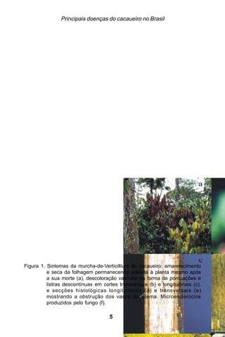 Principais doenças do cacaueiro no Brasil




Figura 1. Sintomas da murcha-de-Verticillium do cacaueiro: amarelecimento
          e seca da folhagem permanecendo aderida à planta mesmo após
          a sua morte (a), descoloração vascular na forma de pontuações e
          listras descontínuas em cortes transversais (b) e longitudinais (c),
          e secções histológicas longitudinais (d) e transversais (e)
          mostrando a obstrução dos vasos do xilema. Microesclerócios
          produzidos pelo fungo (f).

                                     51
 