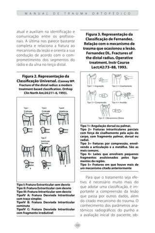 103
M A N U A L D E T R A U M A O R T O P É D I C O
atual e auxiliam na identificação e
comunicação entre os profissio-
nais. A última nos parece bastante
completa e relaciona a fratura ao
mecanismo da lesão e orienta a sua
condução de acordo com o com-
prometimento dos segmentos do
rádio e da ulna no terço distal.
Figura 2. Representação da
Classificação Universal. (Cooney WP.
Fracture of the distal radius: a modern
treatment-based classification. Orthop
Clin North Am;24:211–6, 1993).
Tipo I: Fratura Extrarticular sem desvio
Tipo II: Fratura Extrarticular com desvio
Tipo III: Fratura Intrarticular sem desvio
TipoIV A: Fratura Desviada Intrarticular
com traço simples
TipoIV B: Fratura Desviada Intrarticular
cominuta
TipoIV C: Fratura Desviada Intrarticular
com fragmento irredutível
Figura 3. Representação da
Classificação de Fernandez.
Relação com o mecanismo de
trauma que ocasionou a lesão.
Fernandez DL. Fractures of
the distal radius. Operative
treatment. Instr Course
Lect;42:73–88, 1993.
Tipo 1= Angulação dorsal ou palmar.
Tipo 2= Fraturas intrarticulares parciais
com força de cisalhamento pela ação do
carpo, com fragmento palmar, dorsal ou
radial.
Tipo 3= fraturas por compressão, envol-
vendo a articulação e a metáfise. São as
mais comuns.
Tipo 4= Leões que envolvem pequenos
fragmentos avulsionados pelos liga-
mentos da região.
Tipo 5= Fraturas em que houve mais de
um mecanismo citado anteriormente
Para que o tratamento seja efe-
tivo, é necessário muito mais do
que adotar uma classificação, é im-
portante a compreensão da lesão
que passa por outros dados, além
do citado mecanismo do trauma. O
conhecimento dos parâmetros ana-
tômicos radiográficos do punho e
a avaliação inicial do paciente, ob-
 