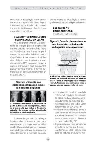 104
M A N U A L D E T R A U M A O R T O P É D I C O
servando a associação com outros
traumas e a qualidade óssea ligada
intimamente à idade, são fatores
imprescindíveis na escolha do trata-
mento bem sucedido.
Diagnóstico radiológico
- Compreensão da Lesão
As radiografias simples são o mé-
todo de eleição para o diagnóstico
das fraturas do terço distal do rádio.
As incidências em frente e perfil
trazem os subsídios básicos para o
diagnóstico. Associamos as incidên-
cias oblíquas, mediopronada e me-
diosupinada (45º do plano do perfil
para a pronação e para supinação),
para evidenciar melhor o desvio das
fraturas e os possíveis segmentos ar-
ticulares (fig. 4).
Figura 4. Utilização das
incidências oblíquas no exame
radiográfico do punho
A. Incidência em frente. B. Incidência em
perfil. C. Incidência mediopronada. Note-
se a seta preta que indica o fragmento
articular dorsoulnar melhor visualizado.
D. Incidência mediosupinada
Podemos lançar mão da radiogra-
fia do punho contralateral para que a
comparação nos traga mais subsídios
na identificação da lesão. Nos casos em
que há degrau articular ou, seja neces-
sário determinar a extensão do com-
prometimento da articulação, a tomo-
grafia computadorizada poderá ser útil.
Parâmetros
Radiográficos:
Incidência em frente (PA):
Figura 5. Desenho demonstrando
medidas vistas na incidência
radiográfica anteroposterior.
A. Altura do rádio: medida entre a extre-
midade da estilóide do rádio e a base da
ulna = 12 mm. B. Inclinação ulnar do rádio
= 23º. C. Variância ulnar: diferença entre a
base da ulna e a base do rádio = 2 mm.
- comprimento do rádio: medida
entre a extremidade da estilóide
do rádio e a base da ulna, apro-
ximadamente 12 mm. (Fig. 5A)
- inclinação ulnar do rádio: valor
aproximado de 23º. (Fig. 5B)
- variância ulnar: diferença entre a
base da ulna e a base do rádio de
aproximadamente 2 mm (deve-
se comparar a mesma diferença
no outro lado). (Fig. 5C)
- degrau articular para as fraturas
articulares: menor que 1 mm.
- afastamento dos fragmentos
para as fraturas articulares: me-
 