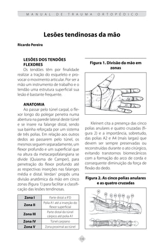 133
M A N U A L D E T R A U M A O R T O P É D I C O
Lesões tendinosas da mão
Ricardo Pereira
Lesões dos tendões
flexores
Os tendões têm por finalidade
realizar a tração do esqueleto e pro-
vocar o movimento articular. Por ser a
mão um instrumento de trabalho e o
tendão uma estrutura superficial sua
lesão é bastante frequente.
Anatomia
Ao passar pelo túnel carpal, o fle-
xor longo do polegar penetra numa
abertura na parede lateral deste túnel
e se insere na falange distal, sendo
sua bainha reforçada por um sistema
de três polias. Em relação aos outros
dedos ao passarem pelo túnel, os
mesmos seguem separadamente, um
flexor profundo e um superficial que
na altura da metacarpofalangiana se
divide (Quiasma de Camper), para
penetração do flexor profundo até
as respectivas inserções nas falanges
média e distal. Verdan1
propôs uma
divisão anatômica da mão em cinco
zonas (figura 1) para facilitar a classifi-
cação das lesões tendinosas.
Zona I Parte distal a IFD
Zona II
Polia A1 até a inserção do
flexor superficial
Zona III
Parte distal do túnel
cárpico até polia A1
Zona IV Túnel carpiano
Zona V Zona proximal ao túnel
Figura 1. Divisão da mão em
zonas
Kleinert cita a presença das cinco
polias anulares e quatro cruzadas (fi-
gura 2) e a importância, sobretudo,
das polias A2 e A4 (mais largas) que
devem ser sempre preservadas ou
reconstruídas durante o ato cirúrgico,
evitando transtornos biomecânicos
com a formação do arco de corda e
consequente diminuição da força de
flexão do dedo.
Figura 2. As cinco polias anulares
e as quatro cruzadas
 