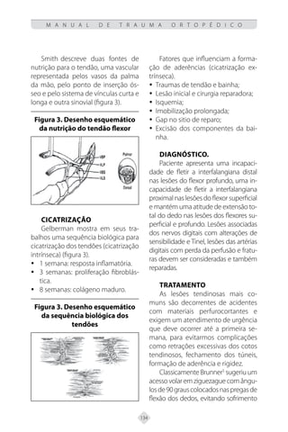 134
M A N U A L D E T R A U M A O R T O P É D I C O
Smith descreve duas fontes de
nutrição para o tendão, uma vascular
representada pelos vasos da palma
da mão, pelo ponto de inserção ós-
seo e pelo sistema de vínculas curta e
longa e outra sinovial (figura 3).
Figura 3. Desenho esquemático
da nutrição do tendão flexor
Cicatrização
Gelberman mostra em seus tra-
balhos uma sequência biológica para
cicatrização dos tendões (cicatrização
intrínseca) (figura 3).
1 semana: resposta inflamatória.
y
y
3 semanas: proliferação fibroblás-
y
y
tica.
8 semanas: colágeno maduro.
y
y
Figura 3. Desenho esquemático
da sequência biológica dos
tendões
Fatores que influenciam a forma-
ção de aderências (cicatrização ex-
trínseca).
Traumas de tendão e bainha;
y
y
Lesão inicial e cirurgia reparadora;
y
y
Isquemia;
y
y
Imobilização prolongada;
y
y
Gap no sitio de reparo;
y
y
Excisão dos componentes da bai-
y
y
nha.
Diagnóstico.
Paciente apresenta uma incapaci-
dade de fletir a interfalangiana distal
nas lesões do flexor profundo, uma in-
capacidade de fletir a interfalangiana
proximal nas lesões do flexor superficial
e mantém uma atitude de extensão to-
tal do dedo nas lesões dos flexores su-
perficial e profundo. Lesões associadas
dos nervos digitais com alterações de
sensibilidade e Tinel, lesões das artérias
digitais com perda da perfusão e fratu-
ras devem ser consideradas e também
reparadas.
Tratamento
As lesões tendinosas mais co-
muns são decorrentes de acidentes
com materiais perfurocortantes e
exigem um atendimento de urgência
que deve ocorrer até a primeira se-
mana, para evitarmos complicações
como retrações excessivas dos cotos
tendinosos, fechamento dos túneis,
formação de aderência e rigidez.
Classicamente Brunner5
sugeriu um
acessovolaremziguezaguecomângu-
losde90grauscolocadosnaspregasde
flexão dos dedos, evitando sofrimento
 