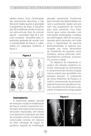 175
M A N U A L D E T R A U M A O R T O P É D I C O
adultos jovens. Essas classificações
são basicamente descritivas e não
fornecem dados quanto à gravidade
e prognóstico da lesão. A classifica-
ção AO é preferida; divide as fraturas
em extra-articular (tipo A), articular
parcial - unicondilar (tipo B) e arti-
cular completa - bicondilar (tipo C),
portando graduada de acordo com
a complexidade da fratura e subdi-
vidida em subgrupos conforme a
figura 2.
Figura 2
Tratamento
O tratamento padrão consiste
em redução cirúrgica e estabilização
da fratura, sendo o tratamento con-
servador reservado às fraturas extra-
articulares impactadas, sem desvio
e em pacientes inoperáveis por falta
de condições clínicas. O tratamento
conservador consiste em repouso
no leito, utilização de tração es-
quelética, seguida da imobilização
gessada, geralmente insuficiente
para correção das deformidades em
varo e acarretando rigidez articular
com mau prognóstico de marcha
para esses pacientes. Esse trata-
mento gera custos elevados com
internações prolongadas, cuidados
de enfermagem, além de ser pouco
tolerado pelos pacientes com lesão
única e impraticável no paciente
politraumatizado. O repouso pro-
longado traz riscos decorrentes
do imobilismo do paciente como
trombose venosa profunda, trom-
boembolismo pulmonar, pneumo-
nia, escaras e sepse.
Os objetivos do tratamento ci-
rúrgico são redução anatômica ar-
ticular, restauração do alinhamento
e comprimento do membro, fixação
interna estável que possibilite mo-
bilização precoce. O surgimento
de novos implantes de fixação e a
melhor compreensão da personali-
dade da fratura tem gerado um me-
lhor resultado funcional para o pa-
ciente. O tratamento cirúrgico pode
Figura 3
 