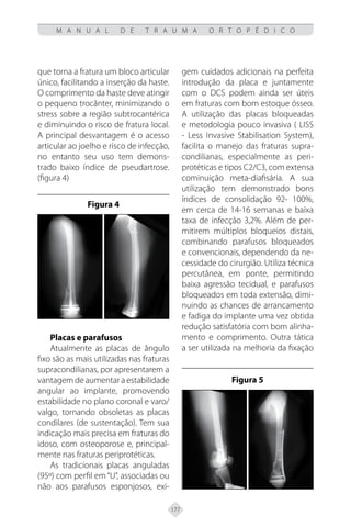 177
M A N U A L D E T R A U M A O R T O P É D I C O
que torna a fratura um bloco articular
único, facilitando a inserção da haste.
O comprimento da haste deve atingir
o pequeno trocânter, minimizando o
stress sobre a região subtrocantérica
e diminuindo o risco de fratura local.
A principal desvantagem é o acesso
articular ao joelho e risco de infecção,
no entanto seu uso tem demons-
trado baixo índice de pseudartrose.
(figura 4)
Figura 4
Placas e parafusos
Atualmente as placas de ângulo
fixo são as mais utilizadas nas fraturas
supracondilianas, por apresentarem a
vantagem de aumentar a estabilidade
angular ao implante, promovendo
estabilidade no plano coronal e varo/
valgo, tornando obsoletas as placas
condilares (de sustentação). Tem sua
indicação mais precisa em fraturas do
idoso, com osteoporose e, principal-
mente nas fraturas periprotéticas.
As tradicionais placas anguladas
(95º) com perfil em “U”, associadas ou
não aos parafusos esponjosos, exi-
gem cuidados adicionais na perfeita
introdução da placa e juntamente
com o DCS podem ainda ser úteis
em fraturas com bom estoque ósseo.
A utilização das placas bloqueadas
e metodologia pouco invasiva ( LISS
- Less Invasive Stabilisation System),
facilita o manejo das fraturas supra-
condilianas, especialmente as peri-
protéticas e tipos C2/C3, com extensa
cominuição meta-diafisária. A sua
utilização tem demonstrado bons
índices de consolidação 92- 100%,
em cerca de 14-16 semanas e baixa
taxa de infecção 3,2%. Além de per-
mitirem múltiplos bloqueios distais,
combinando parafusos bloqueados
e convencionais, dependendo da ne-
cessidade do cirurgião. Utiliza técnica
percutânea, em ponte, permitindo
baixa agressão tecidual, e parafusos
bloqueados em toda extensão, dimi-
nuindo as chances de arrancamento
e fadiga do implante uma vez obtida
redução satisfatória com bom alinha-
mento e comprimento. Outra tática
a ser utilizada na melhoria da fixação
Figura 5
 