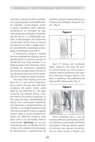 190
M A N U A L D E T R A U M A O R T O P É D I C O
minuição, ausência de falha metafísá-
ria, ou para aqueles muito debilitados.
Os métodos conservadores seriam
a tração esquelética pelo calcâneo,
confiando-se no princípio da liga-
mentotaxia para redução e estabiliza-
ção da fratura, e a imobilização ges-
sada. A desvantagem do tratamento
conservador, mesmo para as fraturas
sem desvio, é o maior a rigidez articu-
lar, osteodistrofia, inatividade prolon-
gada, e reabilitação mais difícil3
.
O tratamento cirúrgico é dotado
de uma variedade de métodos, que se
aperfeiçoaram e evoluíram sempre no
sentido de uma maior atenção e cui-
dado às partes moles. Portanto, o bom
resultado do tratamento operatório
das fraturas do pilão tibial é função di-
reta da preservação (ou mínima agres-
são) do envelope de cobertura óssea.
Nos casos mais simples, como nos
tipos B e C1, com menor fragmenta-
ção e desvio articular, além das boas
condições de partes moles, pode
optar-se, nas primeiras 6 a 12h após
o trauma, por redução aberta e fixa-
ção interna com placas e parafusos. Já
nos casos de maior complexidade da
fratura, com cominuição importante,
encurtamento e desalinhamento do
membro, e conseqüentemente maior
sofrimento de partes moles, as opções
recaem sobre o uso dos fixadores ex-
ternos, em diferentes maneiras. Uma
delas seria o uso do fixador externo
transarticular (spanning) em um pri-
meiro tempo ,por um período de 10 a
14 dias, com o objetivo de restauração
do alinhamento e comprimento do
membro, redução indireta da fratura, e
melhora das condições de partes mo-
les2,7
. (fig. 4)
Figura 4
Num 2o
tempo, em condições
ideais, realiza-se, por meio de aces-
sos convencionais ou minia cessos, a
redução aberta (anatômica da super-
fície articular) e fixação interna, com
placa e parafusos, de preferência de
baixo perfil e bloqueadas. (fig. 5)
Figura 5
Outra estratégia seria o uso, de
maneira definitiva, de fixadores exter-
nos híbridos ou articulados (Orthofix),
associados à redução aberta superfí-
cie articular, por acessos convencio-
nais ou minia cessos, e fixação com
 