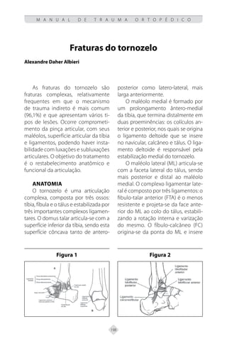 198
M A N U A L D E T R A U M A O R T O P É D I C O
Fraturas do tornozelo
Alexandre Daher Albieri
As fraturas do tornozelo são
fraturas complexas, relativamente
frequentes em que o mecanismo
de trauma indireto é mais comum
(96,1%) e que apresentam vários ti-
pos de lesões. Ocorre comprometi-
mento da pinça articular, com seus
maléolos, superfície articular da tíbia
e ligamentos, podendo haver insta-
bilidade com luxações e subluxações
articulares. O objetivo do tratamento
é o restabelecimento anatômico e
funcional da articulação.
Anatomia
O tornozelo é uma articulação
complexa, composta por três ossos:
tíbia, fíbula e o tálus e estabilizada por
três importantes complexos ligamen-
tares. O domus talar articula-se com a
superfície inferior da tíbia, sendo esta
superfície côncava tanto de antero-
posterior como latero-lateral, mais
larga anteriormente.
O maléolo medial é formado por
um prolongamento ântero-medial
da tíbia, que termina distalmente em
duas proeminências: os colículos an-
terior e posterior, nos quais se origina
o ligamento deltoide que se insere
no navicular, calcâneo e tálus. O liga-
mento deltoide é responsável pela
estabilização medial do tornozelo.
O maléolo lateral (ML) articula-se
com a faceta lateral do tálus, sendo
mais posterior e distal ao maléolo
medial. O complexo ligamentar late-
ral é composto por três ligamentos: o
fibulo-talar anterior (FTA) é o menos
resistente e projeta-se da face ante-
rior do ML ao colo do tálus, estabili-
zando a rotação interna e varização
do mesmo. O fíbulo-calcâneo (FC)
origina-se da ponta do ML e insere
Figura 1 Figura 2
 