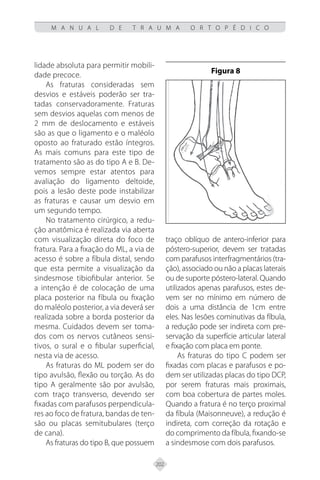 202
M A N U A L D E T R A U M A O R T O P É D I C O
lidade absoluta para permitir mobili-
dade precoce.
As fraturas consideradas sem
desvios e estáveis poderão ser tra-
tadas conservadoramente. Fraturas
sem desvios aquelas com menos de
2 mm de deslocamento e estáveis
são as que o ligamento e o maléolo
oposto ao fraturado estão íntegros.
As mais comuns para este tipo de
tratamento são as do tipo A e B. De-
vemos sempre estar atentos para
avaliação do ligamento deltoide,
pois a lesão deste pode instabilizar
as fraturas e causar um desvio em
um segundo tempo.
No tratamento cirúrgico, a redu-
ção anatômica é realizada via aberta
com visualização direta do foco de
fratura. Para a fixação do ML, a via de
acesso é sobre a fíbula distal, sendo
que esta permite a visualização da
sindesmose tibiofibular anterior. Se
a intenção é de colocação de uma
placa posterior na fíbula ou fixação
do maléolo posterior, a via deverá ser
realizada sobre a borda posterior da
mesma. Cuidados devem ser toma-
dos com os nervos cutâneos sensi-
tivos, o sural e o fibular superficial,
nesta via de acesso.
As fraturas do ML podem ser do
tipo avulsão, flexão ou torção. As do
tipo A geralmente são por avulsão,
com traço transverso, devendo ser
fixadas com parafusos perpendicula-
res ao foco de fratura, bandas de ten-
são ou placas semitubulares (terço
de cana).
As fraturas do tipo B, que possuem
traço oblíquo de antero-inferior para
póstero-superior, devem ser tratadas
com parafusos interfragmentários (tra-
ção), associado ou não a placas laterais
ou de suporte póstero-lateral. Quando
utilizados apenas parafusos, estes de-
vem ser no mínimo em número de
dois a uma distância de 1cm entre
eles. Nas lesões cominutivas da fíbula,
a redução pode ser indireta com pre-
servação da superfície articular lateral
e fixação com placa em ponte.
As fraturas do tipo C podem ser
fixadas com placas e parafusos e po-
dem ser utilizadas placas do tipo DCP,
por serem fraturas mais proximais,
com boa cobertura de partes moles.
Quando a fratura é no terço proximal
da fíbula (Maisonneuve), a redução é
indireta, com correção da rotação e
do comprimento da fíbula, fixando-se
a sindesmose com dois parafusos.
Figura 8
 