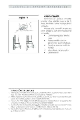 205
M A N U A L D E T R A U M A O R T O P É D I C O
Complicações
Consolidação viciosa: encurta-
mento e/ou rotação externa da fí-
bula, levando a uma incongruência
articular.
Artrose pós traumática que po-
dem chegar à 90% em fraturas mal
reduzidas
Distrofia simpático reflexa:
y
y
raras
Sinostose tibio-fibular:
y
y
geralmente assintomáticas.
Pseudoartrose do maléolo
y
y
medial
Infecção de partes moles
y
y
Osteomielite
y
y
Figura 13
SUGESTÕES DE LEITURA
Walling,AK; Sanders RW. Ankle Fractures. In: Coughlin,MJ; Mann, RA; Saltzman,CL. Surgery of the
1.
Foot and Ankle. Philadelphia: Mosby Elsevier, 2007. p. 1973-2016
Miller, AN; Carrol, EA; Parker, RJ; Boraiah, S; Helfet, DL; Lorich, DG. Direct visualization for stabili-
2.
zation of ankle fractures. Foot & Ankle Int. 2009; 30: 419-426
Tejwani, NC; Pahk, B; Egol, Kenneth. Effect os posterior malleolus fracture on outcome after
3.
unstable ankle fracture. The Journal of Trauma. 2010; 69: 666-669
Gardner, MJ; Demetrakopoulos, D; Briggs, SM; Helfet, DL; Lorich, DG. Malreduction of the tibio-
4.
fibular syndesmosis in ankle fractures. Foot & Ankle Int. 2006; 27: 788-792
Sakaki, MH; Fraturas Maleolares. Orto&Trauma A revista do trauma ortopédico, São Paulo, v. 9,
5.
p. 12-22, janeiro 2011
 