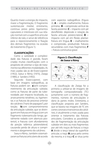 213
M A N U A L D E T R A U M A O R T O P É D I C O
Quanto maior a energia do impacto,
maior a fragmentação. O fragmento
sustentacular medial, entretanto,
continua preso pelos ligamentos
capsulares e interósseo em sua rela-
ção normal com a superfície articular
inferior do talo, e serve de referência
para o reposicionamento e fixação
dos demais fragmentos na ocasião
do tratamento (Figura 1).
Classificações
Como a variedade e complexi-
dade das fraturas é grande, foram
criadas muitas classificações com o
propósito de orientar o tipo de trata-
mento nas diferentes modalidades. As
mais usadas são as de Essex-Lopresti
(1952), Soeur e Rémy (1975), Zwipp
(1989), e Sanders (1992).
Segundo Essex-Lopresti, com
base em imagens radiográficas, as
fraturas podem ser: a)sem compro-
metimento da articulação subtalar,
como as fraturas de parte da tube-
rosidade, por impacto localizado, ou
arrancamento tendíneo, ou ligamen-
tar, e as fraturas do processo anterior
do calcâneo (“nariz de papagaio”), por
torção; b)com comprometimento
da articulação subtalar, que se distin-
guem em fraturas em língua (com um
fragmento tuberoarticular longo, ge-
ralmente rodado com abertura pos-
terior), e fraturas com afundamento
da porção talâmica pósterolateral,
causando perda de altura e compri-
mento e alargamento do calcâneo.
Soeur e Rémy , também sistemati-
zaram as fraturas articulares de acordo
com aspectos radiográficos (Figura
2): A – simples cisalhamento, fratura
primária; B – compressão vertical da
faceta posterior; C – impacto com pé
dorsifletido: depressão e rotação da
faceta articular póstero-lateral; D –
impacto com pé em flexão plantar:
fratura em língua; E – cisalhamento
e compressão, produzindo fraturas
secundárias com mais fragmentos; F
– fratura cominutiva grave
Figura 2. Classificação
de Soeur e Rémy
A classificação de Zwipp foi a
primeira a utilizar-se de imagens de
tomografia computadorizada (TC)
juntamente com o número de frag-
mentos, número de articulações e
dano às partes moles. Entretanto, a
classificação proposta por Sanders,
que se baseia nas imagens de TC em
cortescoronaisetransversosdocalcâ-
neo, é atualmente a mais usada para
orientar o tratamento das fraturas
articulares. Considera as possibilida-
des de fragmentação da articulação
subtalar em dois ou mais fragmentos
por até três traços de fratura: o traço
A divide o terço lateral da superfície
articular, o traço B passa pelo centro
da mesma, e o traço C se situa junto
 