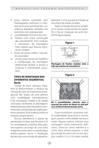 24
M A N U A L D E T R A U M A O R T O P É D I C O
pinos cônicos revestidos com
f)
hidroxiapatita melhoram a inter-
face pino-osso aumentando a re-
sistência (bastante utilizados em
pacientes com osteoporose).
2. a estabilidade intrínseca do osso
fraturas com maior cominução
a)
são naturalmente mais instáveis
e necessitam de montagens
mais estáveis que fraturas trans-
versas simples.
3. lesões de partes moles e vascula-
res associadas
muitas vezes temos de modificar
a)
a configuração da montagem
objetivando facilitar o acesso a
curativos e intervenções vascu-
lares.
Tipos de montagem nos
diferentes segmentos:
Bacia:
Clampe de Ganz: diversos traba-
lhos já demonstraram a eficácia do
clampe de Ganz no tratamento emer-
gencial das lesões do anel pélvico
com instabilidade hemodinâmica.
É de concepção simples e de rápida
colocação, facilitando as abordagens
abdominais quando necessário e pro-
movendo compressão da região pos-
terior da pelve, local onde ocorrem os
maiores sangramentos.
Técnica: identifica-se o ponto de
penetração no ilíaco que fica de 8 a 10
cm anterolateral à espinha ilíaca pós-
tero-superior, ao longo de uma linha
imaginária entre esta e a espinha ilíaca
ântero-superior. Faz-se a introdução
do pino por uma incisão de aproxima-
damente 1 cm e sua ponta é fixada ao
osso ilíaco de ambos os lados.
Após a inserção dos pinos, acopla-
se os outros componentes do apare-
lho e faz-se impacção do anel con-
forme figura abaixo.
Figura 1
Montagem do fixador modular tubo a
tubo para lesões do anel pélvico:
Figura 2
Há 2 possibilidades clássicas para a
inserção dos pinos de Shanz no anel pél-
vico conforme demonstração acima.
Supra-acetabular: promove mai-
or estabilidade rotacional à monta-
gem, porém a dificuldade técnica é
maior. Alguns autores indicam essa
montagem como tratamento defi-
nitivo. Toma-se como referência a
crista ilíaca ântero-superior, o sítio
de entrada fica de 4 a 6 cm em dire-
ção caudal e 3 a 4 cm para medial,
 