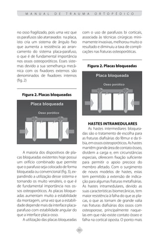 251
M A N U A L D E T R A U M A O R T O P É D I C O
no osso fragilizado, pois uma vez que
os parafusos são atarraxados na placa,
isto cria um sistema de ângulo fixo
que aumenta a resistência ao arran-
camento do sistema placa-parafuso,
o que é de fundamental importância
nos ossos osteoporóticos. Esses siste-
mas devido a sua semelhança mecâ-
nica com os fixadores externos são
denominados de fixadores internos
(fig. 2)
Figura 2. Placas bloqueadas
A maioria dos dispositivos de pla-
cas bloqueadas existentes hoje possui
um orifício combinado que permite
que o parafuso seja colocado de forma
bloqueada ou convencional (fig. 3), ex-
pandindo a utilização desse sistema e
tornando os muito versáteis, o que é
de fundamental importância nos os-
sos osteoporóticos. As placas bloque-
adas aumentam muito a estabilidade
da montagem, uma vez que a estabili-
dadedependemaisdainterfaceplaca-
parafuso com estabilidade angular do
que a interface placa-osso.
A utilização das placas bloqueadas
com o uso de parafusos bi corticais,
associada às técnicas cirúrgicas mini-
mamente invasivas, melhorou muito o
resultado e diminuiu a taxa de compli-
cações nas fraturas osteoporóticas.
Figura 2. Placas bloqueadas
Hastes intramedulares
As hastes intermediares bloquea-
das são o tratamento de escolha para
as fraturas diafisárias do fêmur e da tí-
bia,emossososteoporóticos.Ashastes
mantêmgrandeáreadecontatoósseo,
dividem a carga e, em circunstâncias
especiais, oferecem fixação suficiente
para permitir o apoio precoce do
membro afetado. Com o surgimento
de novos modelos de hastes, estas
tem permitido a extensão de indica-
ção para algumas fraturas metafisárias.
As hastes intramedulares, devido as
suas características biomecânicas, tem
maior resistência à falha do que as pla-
cas, o que as tornam de grande valia
nas fraturas diafisárias dos ossos com
osteoporose, principalmente naque-
las em que não existe contato ósseo e
falha na cortical oposta. O ponto mais
 