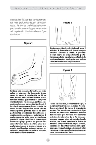 270
M A N U A L D E T R A U M A O R T O P É D I C O
da cicatriz e fáscias dos compartimen-
tos mais profundos devem ser explo-
radas. As formas preferidas pelo autor
para antebraço e mão, perna e torno-
zelo e pé estão discriminadas nas figu-
ras abaixo:
Figura 1
Embora não contenha formalmente mús-
culos, a abertura do ligamento trans-
verso do carpo é mandatória na SC de
mão, através desta incisão volar se acessa
também a fáscia que recobre os comparti-
mentos tenar e hipotenar. A confecção de
cortes adicionais para estes(técnica de 5
incisões) nos parecem desnecessário. No
dorso incisão longitudinal sobre 2o e 4o
metacarpianos permite acessar os com-
partimentos interósseos, lateralmente e
medialmente aos tendões extensores. O
prolongamento volar para o antebraço
proximal segue a linha de S suaves que-
brando na prega palmar do punho bus-
cando fornecer acesso a artéria ulnar e se
prolongando para o braço os vasos bra-
quiais. Modificações podem e devem ser
adotadas a depender da onde se presuma
uma lesão vascular eventual.
Figura 2
Adotamos a técnica de Mubarak com 2
incisões: A ântero-lateral libera compar-
timentos anterior e lateral. A póstero-
medial libera os compartimento poste-
riores superficial e profundo. A facilidade
técnica sobrepões técnicas de uma incisão
como a fibulectomia e a parafibular.
Figura 3
Talvez se encontre, no tornozelo e pé, a
maior controvérsia para incisões. A seme-
lhança do túnel do carpo, é importante
abrir na face anterior do tornozelo os liga-
mentos do retináculo extensor. Embora
demonstrado por Myerson que somente
incisões dorsais sobre 2o e 4o metacar-
piano ou no cavo sobre a transição da pele
plantar com dorsal permitem a liberação
de todos compartimentos do pé. Todavia,
a associação de ambas técnicas como pro-
posto por Strauch, reduz a tensão circular
cutânea e evita o aprofundamento dema-
siado sobre cada uma delas.
 