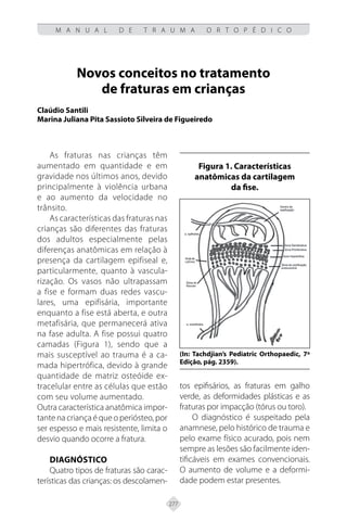 277
M A N U A L D E T R A U M A O R T O P É D I C O
Novos conceitos no tratamento
de fraturas em crianças
Claúdio Santili
Marina Juliana Pita Sassioto Silveira de Figueiredo
As fraturas nas crianças têm
aumentado em quantidade e em
gravidade nos últimos anos, devido
principalmente à violência urbana
e ao aumento da velocidade no
trânsito.
As características das fraturas nas
crianças são diferentes das fraturas
dos adultos especialmente pelas
diferenças anatômicas em relação à
presença da cartilagem epifiseal e,
particularmente, quanto à vascula-
rização. Os vasos não ultrapassam
a fise e formam duas redes vascu-
lares, uma epifisária, importante
enquanto a fise está aberta, e outra
metafisária, que permanecerá ativa
na fase adulta. A fise possui quatro
camadas (Figura 1), sendo que a
mais susceptível ao trauma é a ca-
mada hipertrófica, devido à grande
quantidade de matriz osteóide ex-
tracelular entre as células que estão
com seu volume aumentado.
Outra característica anatômica impor-
tante na criança é que o periósteo, por
ser espesso e mais resistente, limita o
desvio quando ocorre a fratura.
Diagnóstico
Quatro tipos de fraturas são carac-
terísticas das crianças: os descolamen-
tos epifisários, as fraturas em galho
verde, as deformidades plásticas e as
fraturas por impacção (tórus ou toro).
O diagnóstico é suspeitado pela
anamnese, pelo histórico de trauma e
pelo exame físico acurado, pois nem
sempre as lesões são facilmente iden-
tificáveis em exames convencionais.
O aumento de volume e a deformi-
dade podem estar presentes.
Figura 1. Características
anatômicas da cartilagem
da fise.
(In: Tachdjian’s Pediatric Orthopaedic, 7ª
Edição, pág. 2359).
 