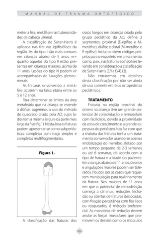303
M A N U A L D E T R A U M A O R T O P É D I C O
meter a fise, metáfise e as tuberosida-
des da cabeça umeral.
A classificação de Salter-Harris é
aplicada nas fraturas epifisiólises da
região. As do tipo I são mais comuns
em crianças abaixo de 5 anos, en-
quanto aquelas do tipo II estão pre-
sentes em crianças maiores, acima de
11 anos. Lesões do tipo III podem vir
acompanhadas de luxações glenou-
merais.
As fraturas envolvendo a metá-
fise ocorrem na faixa etária entre os
5 e 12 anos.
Para determinar os limites da área
metafisária que na criança se estende
à diáfise, sugerimos o uso do método
do quadrado criado pela AO, cujos la-
dos tem a mesma largura da parte mais
largadafise(fig.1).Nestaáreaasfraturas
podem apresentar-se como subperiós-
ticas, completas com traço simples e
completas multifragmentárias.
Figura 1.
A classificação das fraturas dos
ossos longos em crianças criada pelo
grupo pediátrico da AO, define 3
segmentos: proximal (E-epífise e M-
metáfise), diáfise e distal (M-metáfise e
E-epífise). Inclui também códigos pró-
priosparaoesqueletoemcrescimento
como, p.ex., nas fraturas epifisiólises le-
vando em consideração a classificação
de Salter-Harris (E/I a E/4) (2).
Não entraremos em detalhes
desta classificação por não ser ainda
de uso corrente entre os ortopedistas
pediátricos.
TRATAMENTO
Fraturas na região proximal do
úmero na criança têm um grande po-
tencial de consolidação e remodelam
com facilidade, devido à proximidade
da zona de crescimento e a grande es-
pessura do periósteo. Isto faz com que
a maioria das fraturas tenha um trata-
mento conservador usando-se apenas
imobilização do membro afetado por
um tempo pequeno de 2-3 semanas
ou até 6 semanas, de acordo com o
tipo de fratura e a idade do paciente.
Em crianças abaixo de 11 anos, desvios
e angulações maiores podem ser tole-
rados. Poucos são os casos que reque-
rem manipulação para realinhamento
da fratura. Nos maiores de 11 anos
em que o potencial de remodelação
começa a diminuir, reduções fecha-
das ou abertas de fraturas deslocadas,
com fixação percutânea com fios lisos
ou rosqueados, é método preferen-
cial. As manobras de redução devem
anular as forças musculares que pro-
movem os desvios como os músculos
 