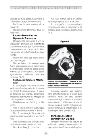 332
M A N U A L D E T R A U M A O R T O P É D I C O
seguido de halo gesso. Raramente o
tratamento cirúrgico é necessário.
Distúrbio de crescimento não é
freqüente.
O diagnóstico diferencial deve ser
feito com .
Ruptura Traumática do
Ligamento Transverso
O ligamento transverso é um es-
tabilizador primário do odontoide.
O aumento maior que 4,5mm entre
odontoide e o arco anterior do Atlas
demonstra a insuficiência deste liga-
mento.
Ocorre em 10% das lesões cervi-
cais das crianças.
Nas avulsões com componente
ósseo (menos comum), o tratamento
é conservador com halo gesso, gesso
Minerva ou órtese cervical. Nas lesões
ligamentares, indica-se artrodese
posterior C1-C2.
Subluxação Rotatória Atlanto-
axial
A subluxação rotatória atlanto-
axial, também chamada de síndrome
de Grisel, freqüentemente é causa
de torcicolo na criança, geralmente
precedida por trauma ou infecção do
trato respiratório superior.
Classificação de Fielding e Ha-
wkins:
Tipo 1: (mais comum) subluxação
facetária unilateral anterior < 3mm
Tipo 2: subluxação facetária uni-
lateral anterior com desvio de 3 a 5
mm
Tipo 3: subluxação facetária bila-
teral anterior com desvio > 5 mm
Tipo 4: subluxação posterior
Nas raras formas tipo 3 e 4, déficit
neurológico pode estar associado.
A tomografia computadorizada
com reconstrução, se disponível, está
indicada para elucidação diagnóstica.
Fig 6
Figura 6.
Fraturas do Odontoide. Observe o aco-
metimento da sincondrose base do odon-
toide e o desvio anterior.
Sintomas agudos são tratados
com antiinflamatórios e colar para
conforto. Acima de uma semana
orienta-se tração craniana e, em casos
mais crônicos (1 mês) necessita-se de
halo gesso para manter redução. Nos
casos irredutíveis é preconizado a ar-
trodese posterior entre C1-C2.
ESPONDILOLISTESE
TRAUMÁTICA DO ÁXIS
Também chamada de fratura do
enforcado, ocorre por mecanismo de
hiper-extensão. Ocorre mais freqüen-
 