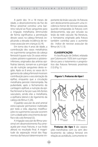 346
M A N U A L D E T R A U M A O R T O P É D I C O
A partir dos 14 a 18 meses de
idade, o desenvolvimento da fise do
fêmur proximal constitui uma bar-
reira natural ao fluxo sanguíneo para
a irrigação metafisária; diminuindo
de forma significativa a penetração
desses vasos na cabeça femoral; ex-
plicando a elevada incidência de ne-
crose avascular em crianças (5,14).
Em torno dos 4 anos de idade, a
contribuição dos vasos metafisários
no suprimento sanguíneo da cabeça
femoral é quase nula. Os vasos retina-
culares póstero-superiores e póstero-
inferiores, originados das artérias epi-
fisárias laterais, tornam-se a principal
via de nutrição sanguíneo desta re-
gião. Após os 8 anos, os vasos do li-
gamento da cabeça femoral mostram
contribuição para a vascularização da
epífise, enquanto que a circulação
metafisária persiste interrompida. Na
puberdade, após o fechamento da
cartilagem epifisial, a nutrição da epí-
fise femoral se faz por suas três fontes
vasculares, sendo elas a metafisária,
a epifisária lateral e do ligamento da
cabeça do fêmur (1,20).
O padrão vascular do anel arterial
extra-capsular permanece inalterado
por toda a vida, algumas modifica-
ções no suprimento vascular ocorrem
com a idade pelo crescimento da epí-
fise e do colo femoral (5).
A irrigação vascular do fêmur pro-
ximal em desenvolvimento fica ame-
açada por essas fraturas, e sua lesão
afetará no resultado final. A magni-
tude da separação inicial dos frag-
mentos da fratura é determinante im-
portante da lesão vascular. As fraturas
sem deslocamento possuem uma in-
cidencia menor de necrose avascular,
quando comparadas às fraturas com
deslocamento, seja por oclusão ou
lesão da rede vascular. Na literatura,
o hematoma originado pela fratura
também contribui para o aumento
do índice de necrose avascular do
fêmur (4,11,13).
CLASSIFICAÇÃO
A classificação de Delbet, relatada
por Colonna em 1929, tem sua impor-
tância para o tratamento e prognós-
tico das fraturas femorais proximais
(12) (Fig. 1).
Figura 1. Fraturas do tipo I
Fraturas do tipo I são separa-
ções transfisárias com ou sem des-
locamento da cabeça femoral em
relação ao acetábulo, comumente re-
 