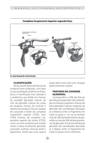 50
M A N U A L D E T R A U M A O R T O P É D I C O
CLASSIFICAÇÃO:
Váriasclassificaçõesdasfraturasda
escápula foram propostas, com base
na sua localização anatômica e frequ-
ência. A classificação mais utilizada é
a anatômica, que divide em: fraturas
da cavidade glenoidal, fraturas do
colo da glenoide, fraturas do corpo
da escápula, fraturas do acrômio e
espinha da escápula, fraturas isoladas
do coracoide e lesões do complexo
suspensório superior (CSSO). Goss
(1993) chamou de complexo sus-
pensório superior do ombro (CSSO),
como um anel composto por tecidos
moles e ósseo envolvendo glenoide,
coracoide, acrômio, clavícula distal e
ligamentos. Sendo que uma ruptura
dupla deste anel criará uma situação
potencialmente instável.
Fraturas da cavidade
glenoidal
Correspondem a 10% das fraturas
dasfraturasdaglenoide.Sãosubdividi-
das em fraturas marginais e fraturas da
fossa glenoidal. Fraturas marginais da
glenoide são consideradas desviadas
se a distância entre os fragmentos for
maior ou igual a 1 cm, ou se envolver
mais de 20% da borda anterior da gle-
noide ou mais de 30% da borda poste-
rior da glenoide. As fraturas da fossa da
glenoide são consideradas desviadas
se o degrau entre os fragmentos for
maior ou igual a cinco milímetros.
Complexo Suspensorio Superior segundo Goss
A: vista lateral; B: vista frontal
 