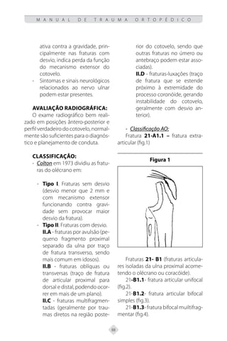 88
M A N U A L D E T R A U M A O R T O P É D I C O
ativa contra a gravidade, prin-
cipalmente nas fraturas com
desvio, indica perda da função
do mecanismo extensor do
cotovelo.
Sintomas e sinais neurológicos
-
-
relacionados ao nervo ulnar
podem estar presentes.
Avaliação radiográfica:
O exame radiográfico bem reali-
zado em posições ântero-posterior e
perfil verdadeiro do cotovelo, normal-
mente são suficientes para o diagnós-
tico e planejamento de conduta.
Classificação:
- Colton em 1973 dividiu as fratu-
ras do olécrano em:
- Tipo I. Fraturas sem desvio
(desvio menor que 2 mm e
com mecanismo extensor
funcionando contra gravi-
dade sem provocar maior
desvio da fratura).
- Tipo II. Fraturas com desvio.
II.A - fraturas por avulsão (pe-
queno fragmento proximal
separado da ulna por traço
de fratura transverso, sendo
mais comum em idosos).
II.B - fraturas oblíquas ou
transversas (traço de fratura
de articular proximal para
dorsal e distal, podendo ocor-
rer em mais de um plano).
II.C - fraturas multifragmen-
tadas (geralmente por trau-
mas diretos na região poste-
rior do cotovelo, sendo que
outras fraturas no úmero ou
antebraço podem estar asso-
ciadas).
II.D - fraturas-luxações (traço
de fratura que se estende
próximo à extremidade do
processo coronóide, gerando
instabilidade do cotovelo,
geralmente com desvio an-
terior).
- Classificação AO:
Fratura 21-A1.1 – fratura extra-
articular (fig.1)
Figura 1
Fraturas 21- B1 (fraturas articula-
res isoladas da ulna proximal acome-
tendo o olécrano ou coracóide).
21-B1.1- fratura articular unifocal
(fig.2).
21-B1.2- fratura articular bifocal
simples (fig.3).
21-B1.3- fratura bifocal muiltifrag-
mentar (fig.4).
 