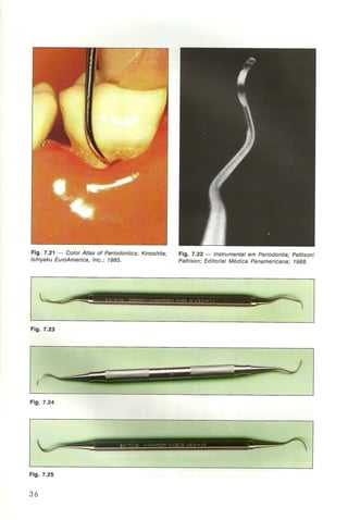 Livro:Manual de Periodontia  - odontostation@gmail.com