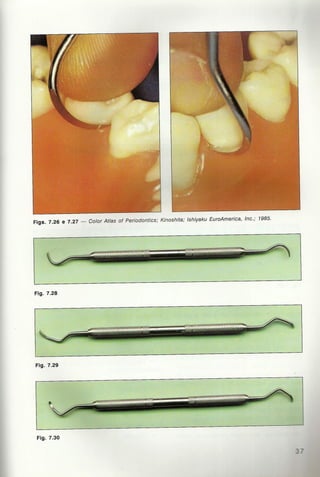 Livro:Manual de Periodontia  - odontostation@gmail.com