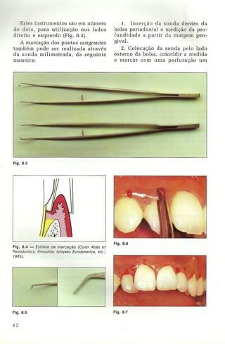 Livro:Manual de Periodontia  - odontostation@gmail.com
