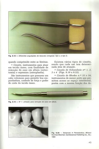 Livro:Manual de Periodontia  - odontostation@gmail.com
