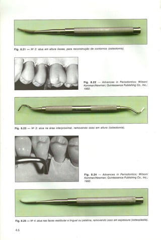 Livro:Manual de Periodontia  - odontostation@gmail.com