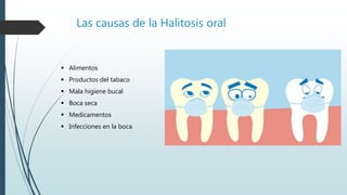 Las causas de la Halitosis oral
 Alimentos
 Productos del tabaco
 Mala higiene bucal
 Boca seca
 Medicamentos
 Infecciones en la boca
 
