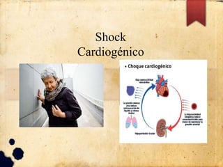 Shock
Cardiogénico
 