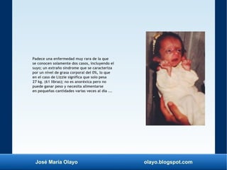 José María Olayo olayo.blogspot.com
Padece una enfermedad muy rara de la que
se conocen solamente dos casos, incluyendo el
suyo; un extraño síndrome que se caracteriza
por un nivel de grasa corporal del 0%, lo que
en el caso de Lizzie significa que solo pesa
27 kg. (61 libras); no es anoréxica pero no
puede ganar peso y necesita alimentarse
en pequeñas cantidades varias veces al día ...
 