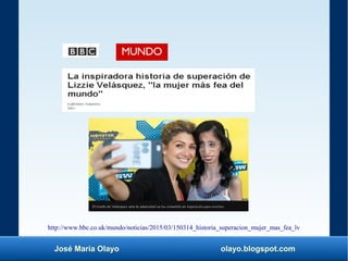 José María Olayo olayo.blogspot.com
http://www.bbc.co.uk/mundo/noticias/2015/03/150314_historia_superacion_mujer_mas_fea_lv
 