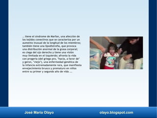 José María Olayo olayo.blogspot.com
… tiene el síndrome de Marfan, una afección de
los tejidos conectivos que se caracteriza por un
aumento inusual de la longitud de los miembros;
también tiene una lipodistrofia, que provoca
una distribución anormal de la grasa corporal;
es ciega del ojo derecho y tiene una visión
muy limitada en el izquierdo; afronta la vida
con progeria (del griego pro, "hacia, a favor de"
y geron, "viejo"), una enfermedad genética de
la infancia extremadamente rara, que manifiesta
envejecimiento brusco y prematuro en niños
entre su primer y segundo año de vida ...
 