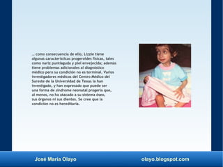 José María Olayo olayo.blogspot.com
… como consecuencia de ello, Lizzie tiene
algunas características progeroides físicas, tales
como nariz puntiaguda y piel envejecida; además
tiene problemas adicionales al diagnóstico
médico pero su condición no es terminal. Varios
investigadores médicos del Centro Médico del
Sureste de la Universidad de Texas la han
investigado, y han expresado que puede ser
una forma de síndrome neonatal progeria que,
al menos, no ha atacado a su sistema óseo,
sus órganos ni sus dientes. Se cree que la
condición no es hereditaria.
 