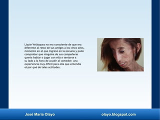 José María Olayo olayo.blogspot.com
Lizzie Velásquez no era consciente de que era
diferente al resto de sus amigos a los cinco años,
momento en el que ingresó en la escuela y pudo
comprobar que ninguina de sus compañeras
quería hablar o jugar con ella o sentarse a
su lado a la hora de acudir al comedor; una
experiencia muy difícil para ella que entendía
el por qué de tales actitudes.
 