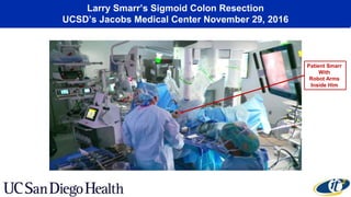 Larry Smarr’s Sigmoid Colon Resection
UCSD’s Jacobs Medical Center November 29, 2016
Patient Smarr
With
Robot Arms
Inside Him
 