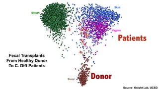 Fecal Transplants
From Healthy Donor
To C. Diff Patients
Source: Knight Lab, UCSD
Mouth
Skin
Vagina
Stool
 