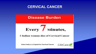 CERVICAL CANCER
 