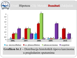 Grafikon br.1 –  Distribucija histoloških tipova karcinoma u pregledanim sputumima 2006.  2007.  2008.  2009.  2010 . Uvod  Hipoteza   Cilj  Metode   Rezultati   Zaključak  