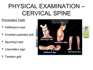 Joshua Decruz Spine Teaching.pptx