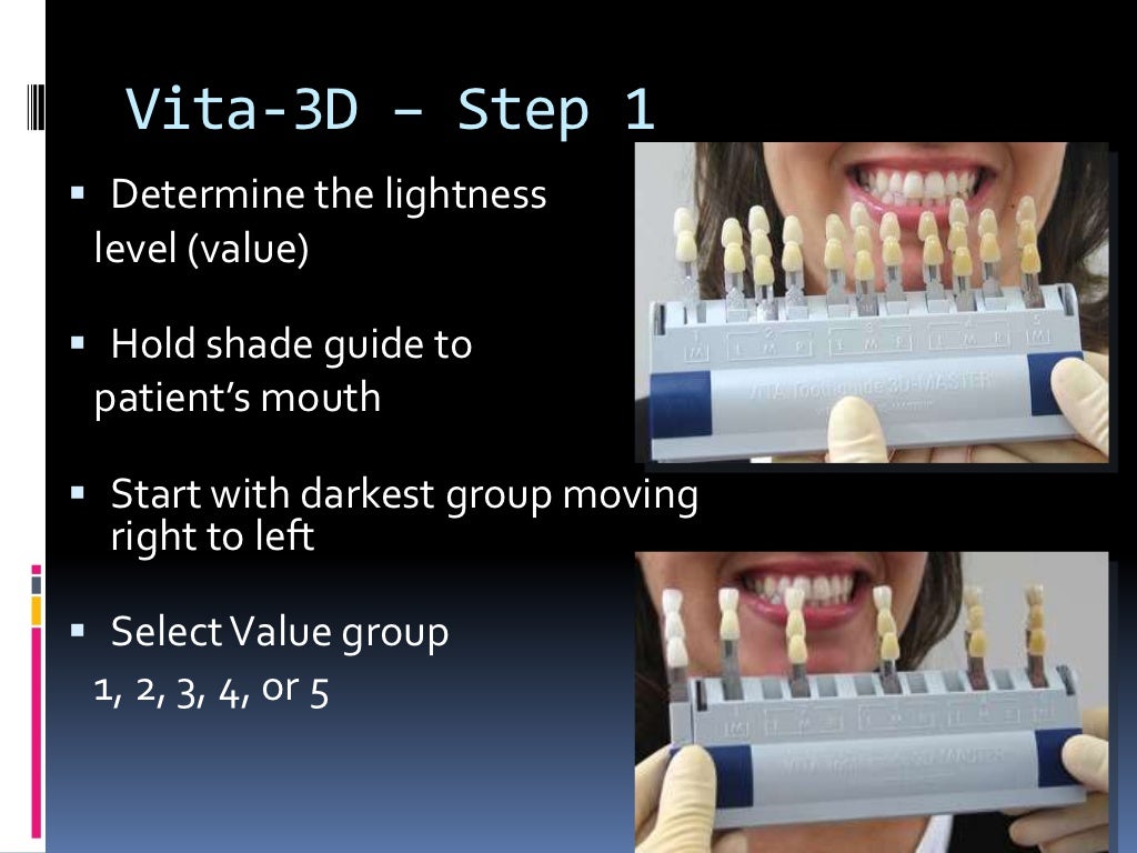 Shade Selection techniques