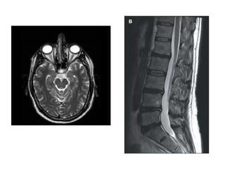 Understanding MRI T1 and T2 Relaxation: Soft Tissue Contrast Mechanisms ...