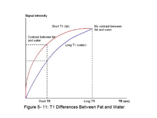 Understanding MRI T1 and T2 Relaxation: Soft Tissue Contrast Mechanisms ...