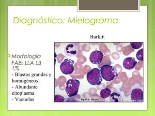 Diagnóstico: Mielograma
                       Burkitt


 Morfología
 FAB: LLA L3
 1%
 - Blastos grandes y
 homogéneos .
 - Abundante
 citoplasma
 - Vacuolas
 