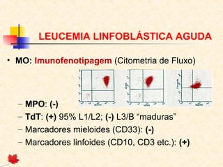 LEUCEMIA LINFOBLÁSTICA AGUDA
• MO: Imunofenotipagem (Citometria de Fluxo)

–
–
–
–

MPO: (-)
TdT: (+) 95% L1/L2; (-) L3/B “maduras”
Marcadores mieloides (CD33): (-)
Marcadores linfoides (CD10, CD3 etc.): (+)

 