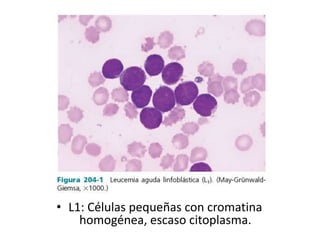 • L1: Células pequeñas con cromatina
homogénea, escaso citoplasma.
 