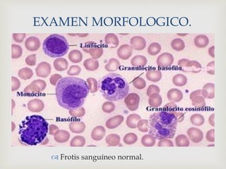 
EXAMEN MORFOLOGICO.
 Frotis sanguíneo normal.
 