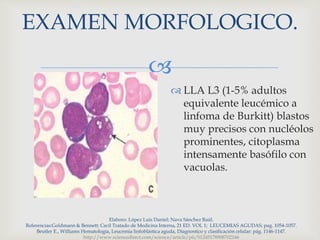 
EXAMEN MORFOLOGICO.
Elaboro: López Luis Daniel; Nava Sánchez Raúl.
Referencias:Goldmann & Bennett: Cecil Tratado de Medicina Interna, 21 ED. VOL 1; LEUCEMIAS AGUDAS; pag. 1054-1057.
Beutler E., Williams Hematología, Leucemia linfoblástica aguda, Diagnostico y clasificación celular: pág. 1146-1147.
http://www.sciencedirect.com/science/article/pii/S1245178908702166
 LLA L3 (1-5% adultos
equivalente leucémico a
linfoma de Burkitt) blastos
muy precisos con nucléolos
prominentes, citoplasma
intensamente basófilo con
vacuolas.
 