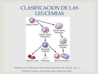 Referencia: Publicación del Instituto Nacional de Cáncer pag. 4
Elaboro: López Luis Daniel, Nava Sánchez Raúl
CLASIFICACION DE LAS
LEUCEMIAS
 