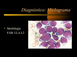 Diagnóstico: Mielograma


• Morfología
  FAB: LLA L2
 