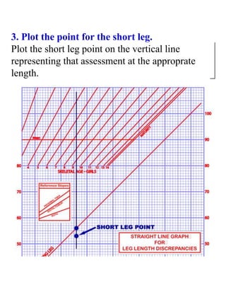 3. Plot the point for the short leg.
Plot the short leg point on the vertical line
representing that assessment at the approprate
length.
 